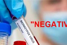 Caso suspeito de varíola dos macacos em Itabira é "NEGATIVO"