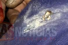 Criança de 11 anos é atingida por disparo de arma de fogo no bairro são Bernardo em Santa Barbara 