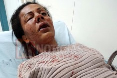 Mulher é brutalmente agredida por termino de relacionamento no bairro Jardim das Oliveiras em Itabira