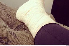 Mulher será ressarcida em mais de R﹩ 70 mil após acidente