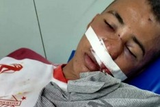 Briga deixa dois com ferimentos graves e filho de Prefeito é suspeito das agressões em Bom Jesus do Amparo 